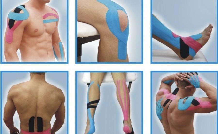 Kinesiotape